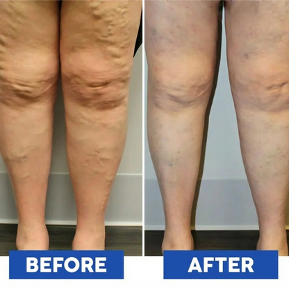 SmartPulse™ Microcurrent Foot Massager